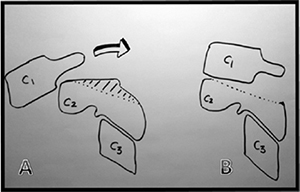 Pre Operative Images