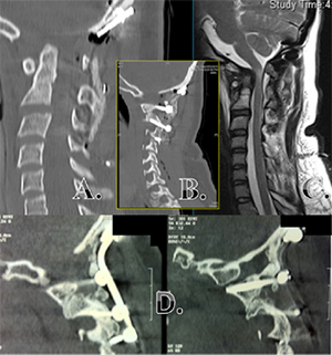 Pre Operative Images