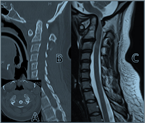 Pre Operative Images