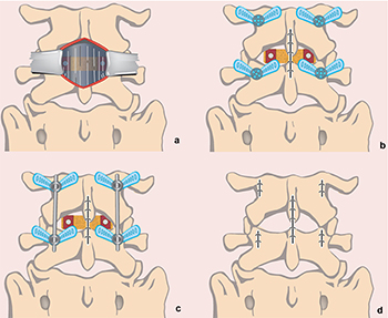 Schematic Diagram