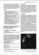 Schwannoma Sciatic Nerve