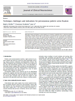 Technique, challenges and indications for percutaneous pedicle screw fixation